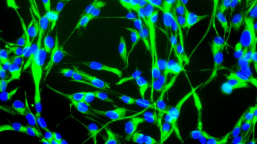 Cellule Staminali Neurali