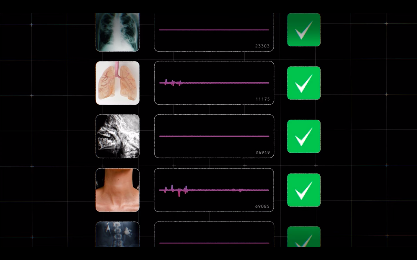 google intelligenza artificiale malattie