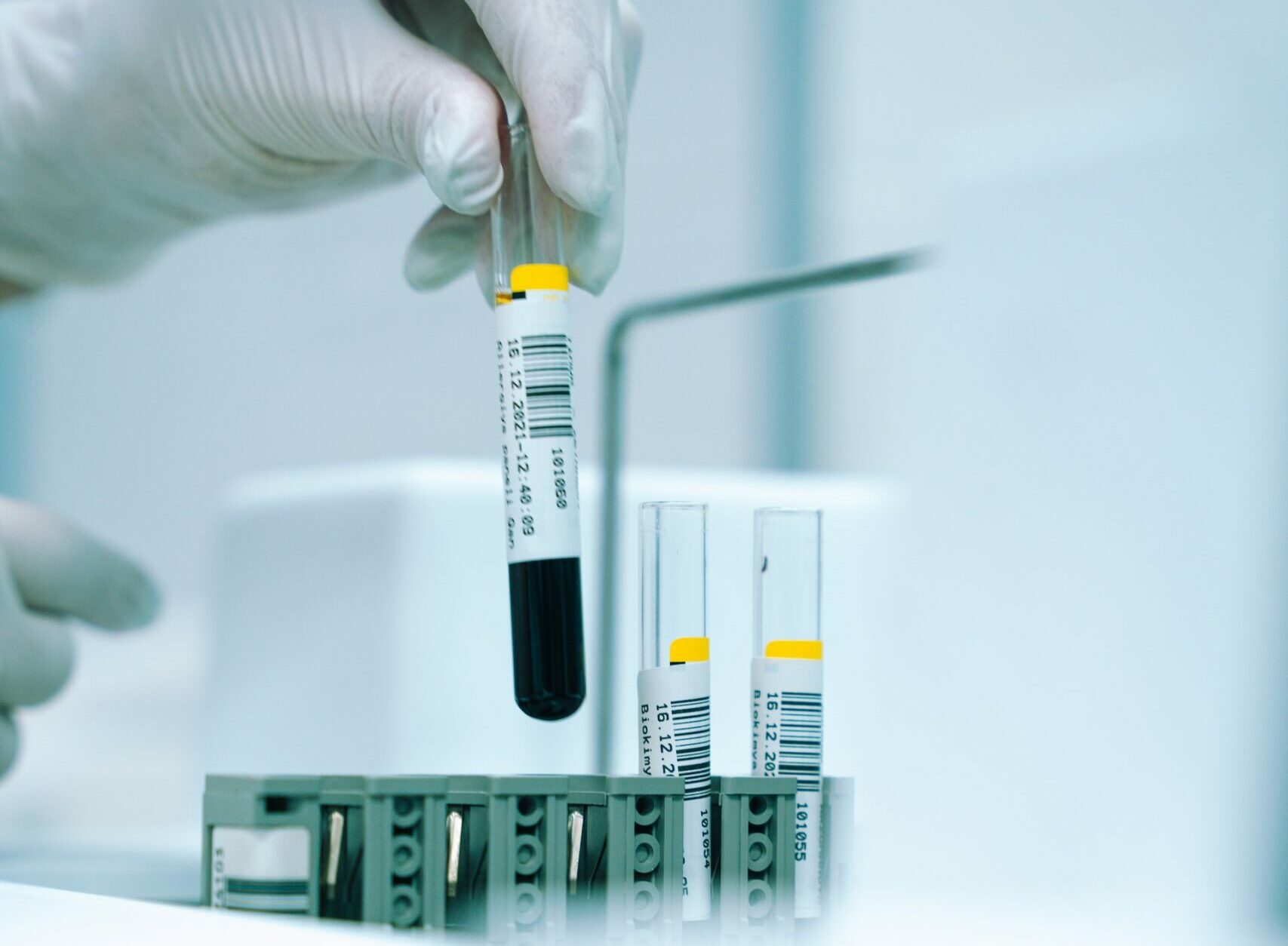 A blood test could predict long Covid