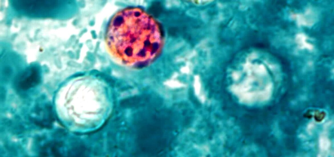 ciclosporiasi stati uniti