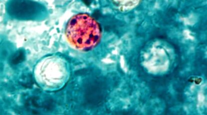 ciclosporiasi stati uniti
