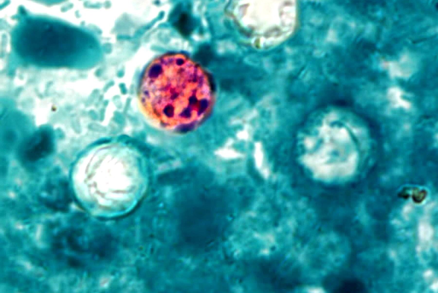ciclosporiasi stati uniti