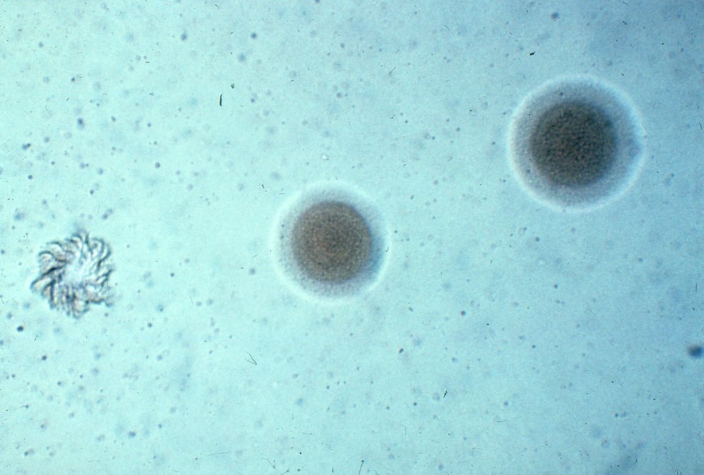 mycoplasma pneumoniae