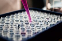 Test Livello Anticorpi