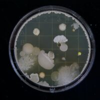 prodotti listeria