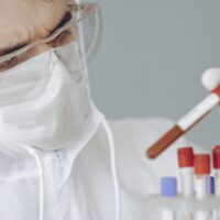 covid test sierologici coronavirus covid-19 plasma iperimmune