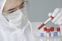 Covid Test Sierologici Coronavirus Covid-19 Plasma Iperimmune