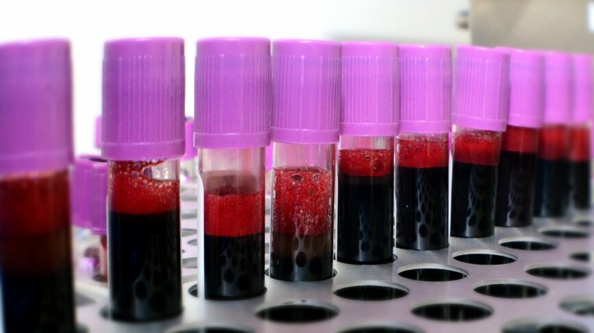 Plasma Diasorin Technogenetics Coronavirus Covid-19 Test Sierologici Governo