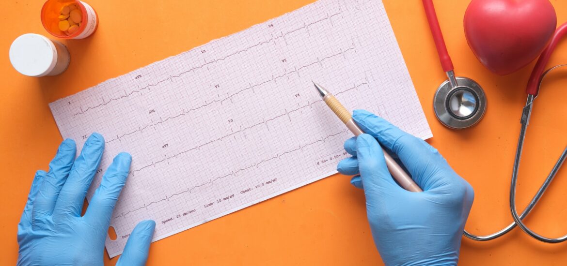 Fibrillazione Atriale Anticoagulanti