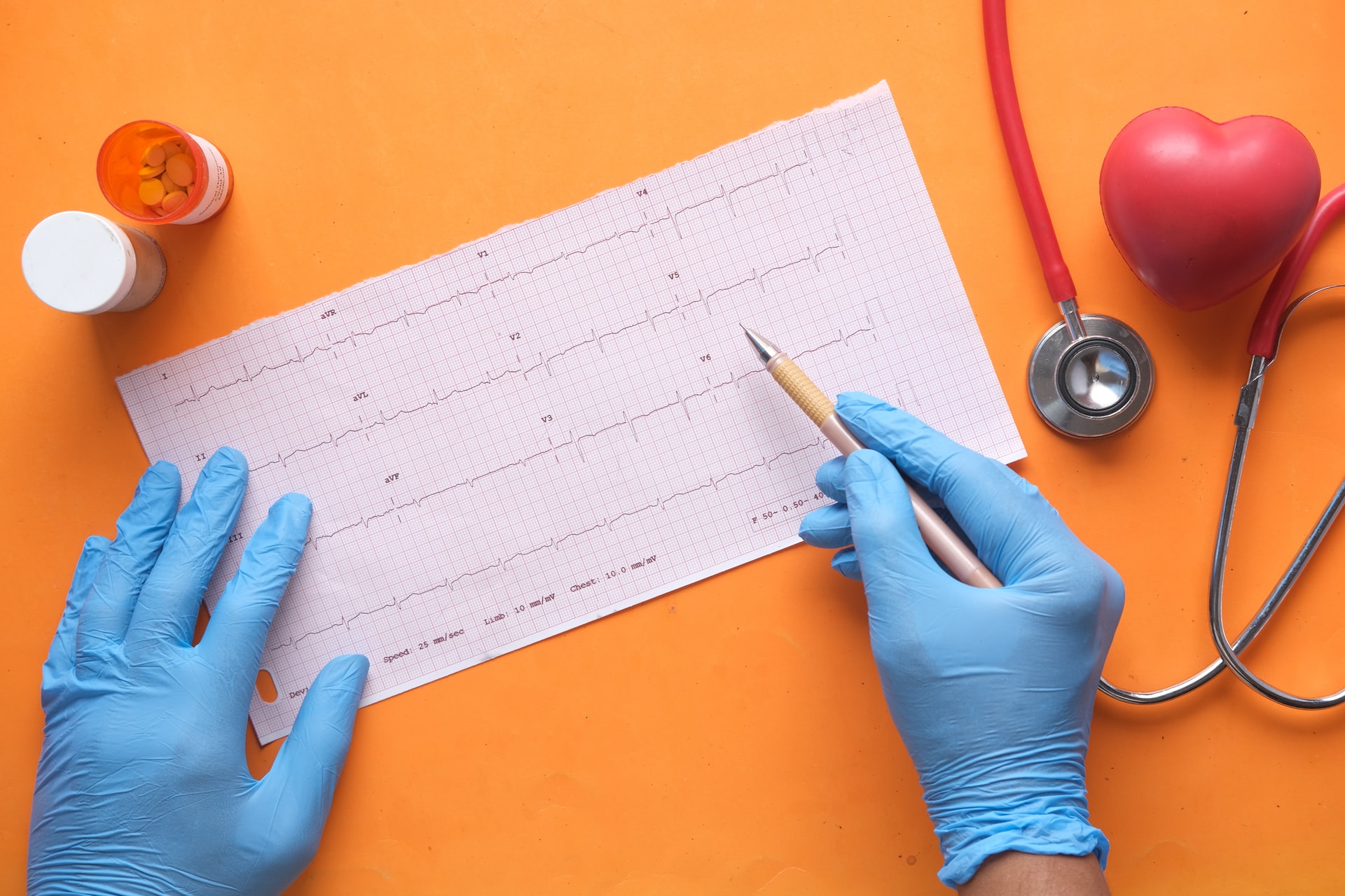 fibrillazione atriale anticoagulanti